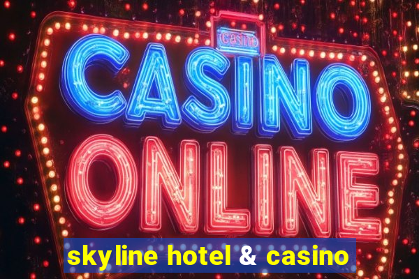 skyline hotel & casino